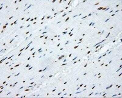 Immunohistochemistry: SHC1 Antibody (OTI3A1) - Azide and BSA Free [NBP2-74167] - Staining of paraffin-embedded colon tissue using anti-SHC1 mouse monoclonal antibody.