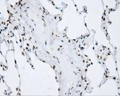Immunohistochemistry: SHC1 Antibody (OTI3A1) - Azide and BSA Free [NBP2-74167] - Staining of paraffin-embedded lung tissue using anti-SHC1 mouse monoclonal antibody.