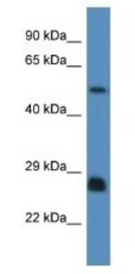 Western Blot: SHC3 Antibody [NBP1-79656] - Mouse Spleen Lysate 1ug/ml  Gel Concentration 12%