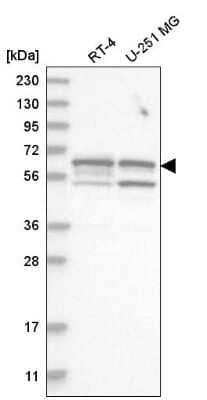 Western Blot: SHC3 Antibody [NBP2-58795] - Western blot analysis in human cell line RT-4 and human cell line U-251 MG.