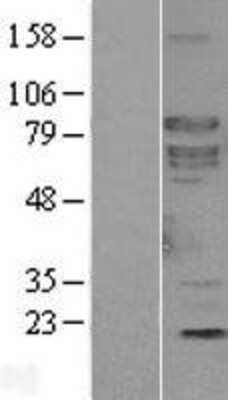 Western Blot: SHC4 Overexpression Lysate (Adult Normal) [NBL1-15937] Left-Empty vector transfected control cell lysate (HEK293 cell lysate); Right -Over-expression Lysate for SHC4.