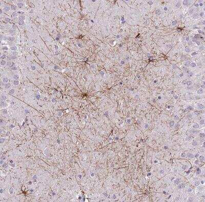 Immunohistochemistry-Paraffin SHCBP1 Antibody