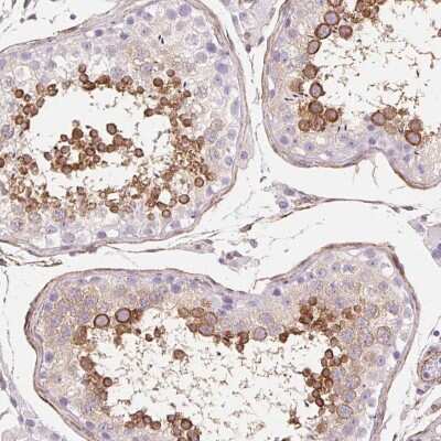 Immunohistochemistry: SHCBP1L Antibody [NBP2-39034] - Staining of human testis shows strong cytoplasmic positivity in subset of cells in seminiferus ducts.