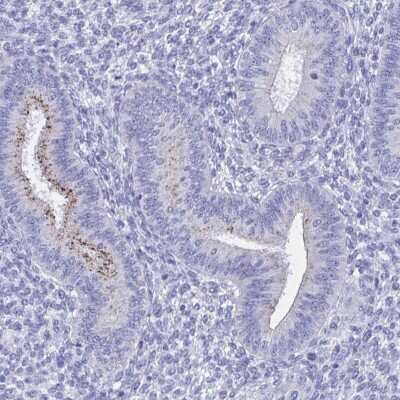 Immunohistochemistry-Paraffin: SHCBP1L Antibody [NBP1-90716] - Staining of human endometrium shows low expression as expected.