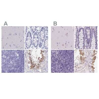 Immunohistochemistry-Paraffin: SHCBP1L Antibody [NBP1-90716] - Staining of human cerebral cortex, colon, lymph node and testis using Anti-SHCBP1L antibody NBP1-90716 (A) shows similar protein distribution across tissues to independent antibody NBP2-39034 (B).