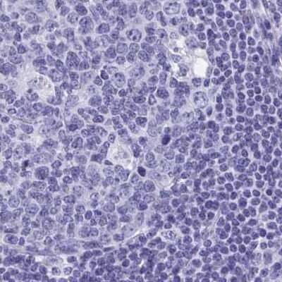 Immunohistochemistry-Paraffin: SHCBP1L Antibody [NBP1-90716] - Staining of human lymph node.