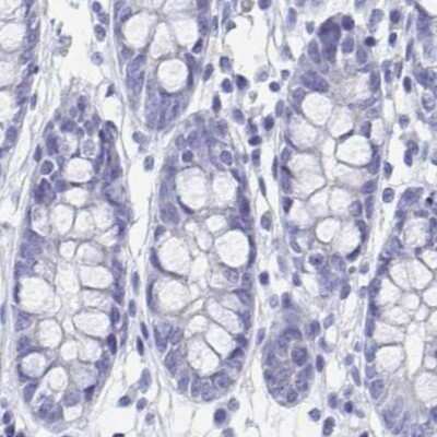 Immunohistochemistry-Paraffin: SHCBP1L Antibody [NBP1-90716] - Staining of human colon.