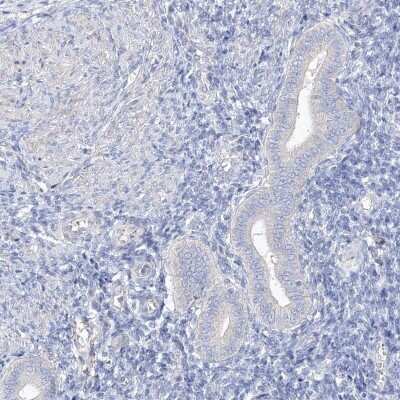 Immunohistochemistry-Paraffin: SHCBP1L Antibody [NBP2-32716] - Staining of human endometrium shows low expression as expected.