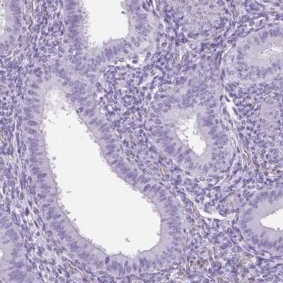 Immunohistochemistry-Paraffin: SHCBP1L Antibody [NBP2-39034] - Staining of human endometrium shows low expression as expected.