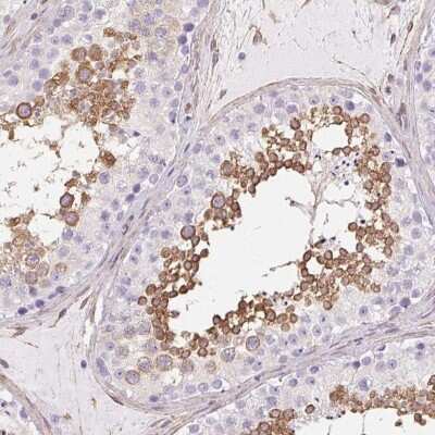 Immunohistochemistry-Paraffin: SHCBP1L Antibody [NBP2-39034] - Staining of human testis shows high expression.