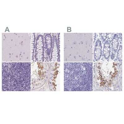 <b>Independent Antibodies Validation. </b>Immunohistochemistry-Paraffin: SHCBP1L Antibody [NBP2-39034] - Staining of human cerebral cortex, colon, lymph node and testis using Anti-SHCBP1L antibody NBP2-39034 (A) shows similar protein distribution across tissues to independent antibody NBP1-90716 (B).