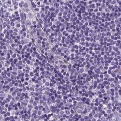 Immunohistochemistry-Paraffin: SHCBP1L Antibody [NBP2-39034] - Staining of human lymph node.