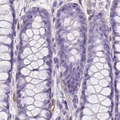 Immunohistochemistry-Paraffin: SHCBP1L Antibody [NBP2-39034] - Staining of human colon.