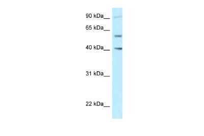 Western Blot: SHCBP1L Antibody [NBP2-88268] - WB Suggested Anti-SHCBP1L Antibody. Titration: 1.0 ug/ml. Positive Control: Jurkat Whole Cell