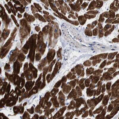 Immunohistochemistry-Paraffin: SHD Antibody [NBP1-86053] - Staining of human heart muscle shows strong cytoplasmic positivity in myocytes.