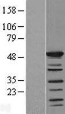 Western Blot SHD Overexpression Lysate