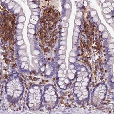 Immunohistochemistry: SHIP Antibody [NBP2-49633] - Staining of human small intestine shows strong cytoplasmic positivity in lymphoid cells.