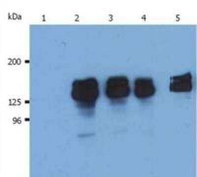 <b>Genetic Strategies Validation. </b>Western Blot: SHIP Antibody (SHIP-01) [NB110-81538] - Analysis (reducing conditions) of human SHIP-1 in whole cell lysate of THP-1 human acute monocytic leukemia cell line. Lane 1: immunostaining with Isotype mouse IgG1 control Lane 2,3: immunostaining with anti-human SHIP-1 (SHIP-01) Lane 4,5: immunostaining with anti-human SHIP-1 (SHIP-02).