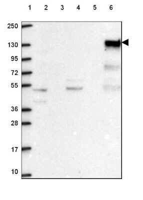 Western Blot: SHIP Antibody [NBP2-49633] - Lane 1: Marker [kDa] 250, 130, 95, 72, 55, 36, 28, 17, 10Lane 2: Human cell line RT-4Lane 3: Human cell line U-251 MGLane 4: Human plasmaLane 5: Human Liver tissueLane 6: Human Tonsil tissue