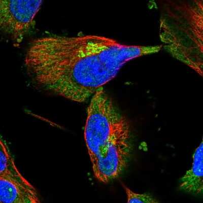 Immunocytochemistry/Immunofluorescence: SHIP2/INPPL1 Antibody [NBP1-87046] - Staining of human cell line U-251 MG shows localization to cytosol & the Golgi apparatus. Antibody staining is shown in green.