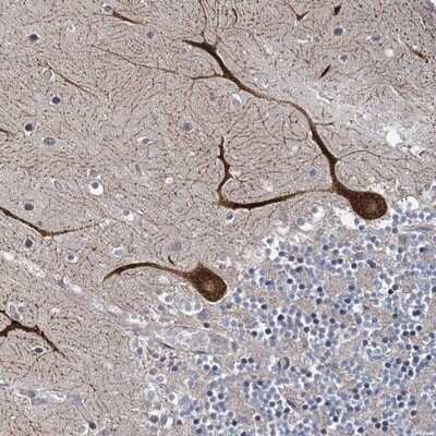 Immunohistochemistry-Paraffin: SHIP2/INPPL1 Antibody [NBP1-87046] - Staining of human cerebellum shows strong cytoplasmic positivity in purkinje cells.