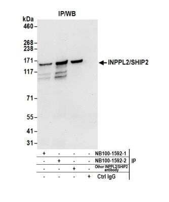 Immunoprecipitation: SHIP2/INPPL1 Antibody [NB100-1592] - Detection of human INPPL2/SHIP2 by western blot of immunoprecipitates. Samples: Whole cell lysate (0.5 or 1.0 mg per IP reaction; 20% of IP loaded) from HeLa cells prepared using NETN lysis buffer. Antibodies: Affinity purified rabbit anti-INPPL2/SHIP2 antibody NB100-1592 (lot NB100-1592-2) used for IP at 6 ug per reaction. INPPL2/SHIP2 was also immunoprecipitated by a previous lot of this antibody (NB100-1592-1) and another rabbit anti-INPPL2/SHIP2 antibody. For blotting immunoprecipitated INPPL2/SHIP2, NB100-1592 was used at 0.4 ug/ml. Detection: Chemiluminescence with an exposure time of 10 seconds.