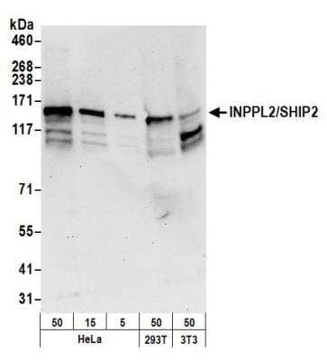 Western Blot: SHIP2/INPPL1 Antibody [NB100-1592] - Detection of Human and Mouse INPPL2/SHIP2 by Western Blot. Samples: Whole cell lysate (50, 15, 5 ug) from HeLa and (50 ug) from 293T and mouse NIH3T3 cells prepared using NETN lysis buffer. Antibody: Affinity purified rabbit anti-INPPL2/SHIP2 antibody NB100-1592 used for WB at 0.1 ug/ml. Detection: Chemiluminescence with an exposure time of 30 seconds.