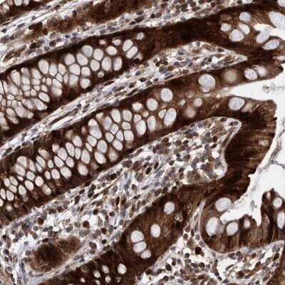Immunohistochemistry-Paraffin: SHISA6 Antibody [NBP1-93747] - Staining of human rectum shows strong cytoplasmic and nuclear positivity in glandular cells.