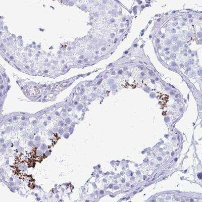 Immunohistochemistry-Paraffin: SHISA8 Antibody [NBP2-32436] - Staining of human testis shows strong cytoplasmic positivity in spermatozoa.