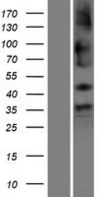 Western Blot SHISA9 Overexpression Lysate