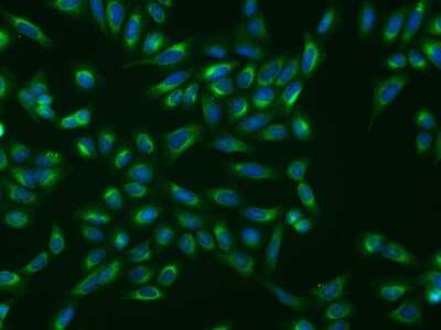 Immunocytochemistry/Immunofluorescence: SHMT1 Antibody [NBP2-97303] - Immunofluorescence staining of SHMT1 in U2OS cells. Cells were fixed with 4% PFA, permeabilzed with 0.1% Triton X-100 in PBS, blocked with 10% serum, and incubated with rabbit anti-Human SHMT1 polyclonal antibody (dilution ratio 1:200) at 4C overnight. Then cells were stained with the Alexa Fluor(R)488-conjugated Goat Anti-rabbit IgG secondary antibody (green) and counterstained with DAPI (blue).Positive staining was localized to Cytoplasm.