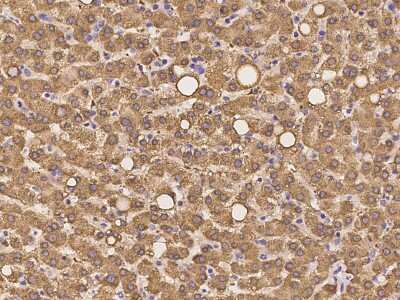 Immunohistochemistry-Paraffin: SHMT1 Antibody [NBP2-97303] - Immunochemical staining of human SHMT1 in human liver with rabbit polyclonal antibody at 1:100 dilution, formalin-fixed paraffin embedded sections.