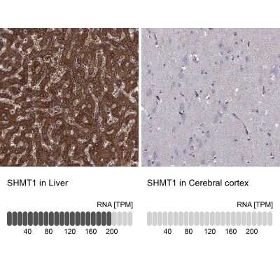 Immunohistochemistry-Paraffin: SHMT1 Antibody [NBP3-17022] - Analysis in human liver and cerebral cortex tissues using Anti-SHMT1 antibody. Corresponding SHMT1 RNA-seq data are presented for the same tissues.