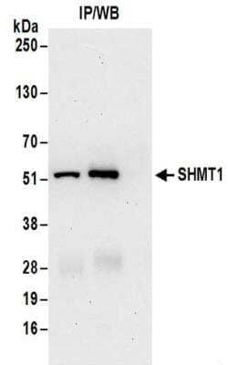 Immunoprecipitation: SHMT1 Antibody [NBP2-32173] - Samples:  Whole cell lysate (0.5 or 1.0 mg per IP reaction; 20% of IP loaded) from Jurkat cells.  Antibodies:  Affinity purified rabbit anti-SHMT1 antibody NBP2-32173 used for IP at 6 ug per reaction.  SHMT1 was also immunoprecipitated by rabbit anti-SHMT1 antibody BL15560.  For blotting immunoprecipitated SHMT1, NBP2-32173 was used at 1 ug/ml.  Detection: Chemiluminescence with an exposure time of 30 seconds.