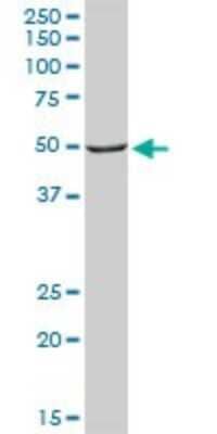Western Blot: SHMT1 Antibody [H00006470-D01P] - Analysis of SHMT1 expression in human liver.
