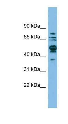 Western Blot: SHMT1 Antibody [NBP1-53192] - A549 cell lysate, concentration 0.2-1 ug/ml.