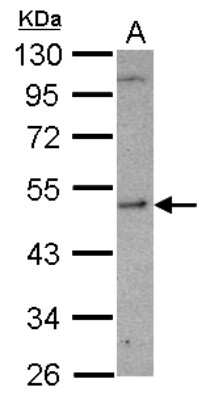 Western Blot: SHMT1 Antibody [NBP2-20353] - Sample (30 ug of whole cell lysate) A: U87-MG 10% SDS PAGE gel, diluted at 1:1000.