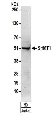 Western Blot: SHMT1 Antibody [NBP2-32173] - Samples:  Whole cell lysate (50 ug) from Jurkat cells. Antibodies:  Affinity purified rabbit anti-SHMT1 NBP2-32173 used for WB at 1 ug/ml.  Detection: Chemiluminescence with an exposure time of 3 minutes.