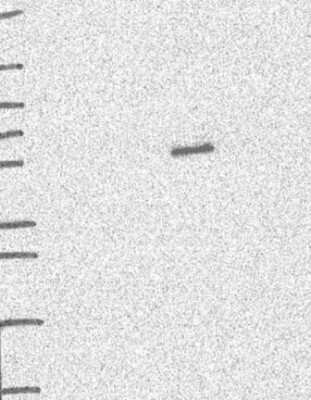 Western Blot: SHMT1 Antibody [NBP3-17022] - Lane 1: Marker [kDa] 250, 130, 95, 72, 55, 36, 28, 17, 10;   Lane 2: RT4;   Lane 3: U-251 MG;   Lane 4: Human Plasma;   Lane 5: Liver;   Lane 6: Tonsil