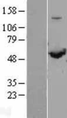 Western Blot SHMT1 Overexpression Lysate