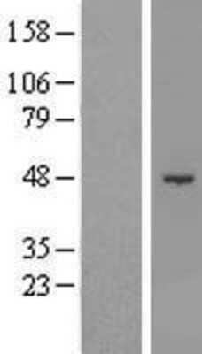 Western Blot SHMT1 Overexpression Lysate