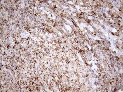 Immunohistochemistry: SHMT2 Antibody (3E9) [NBP2-45826] - Analysis of Human lymph node tissue. (Heat-induced epitope retrieval by 1mM EDTA in 10mM Tris buffer (pH8.5) at 120C for 3 min)