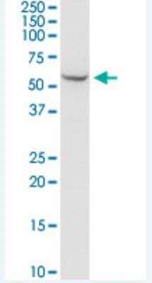 Western Blot: SHMT2 Antibody (5E7) [H00006472-M04-100ug] - SHMT2 monoclonal antibody (M04), clone 5E7. Western Blot analysis of SHMT2 expression in HeLa.