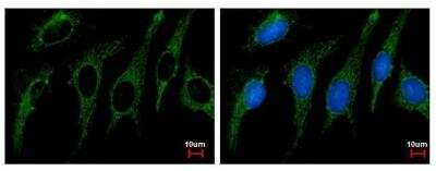 Immunocytochemistry/Immunofluorescence: SHMT2 Antibody [NBP2-20354] - HeLa cells were fixed in ice-cold MeOH for 1 sec. Green: SHMT2 protein stained by SHMT2 antibody  diluted at 1:500. Blue: Hoechst 33342 staining.