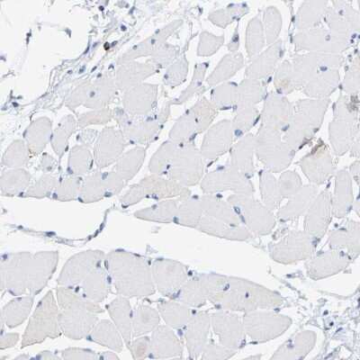 Immunohistochemistry-Paraffin: SHMT2 Antibody [NBP1-80754] - Staining of human skeletal muscle shows no positivity in myocytes as expected.