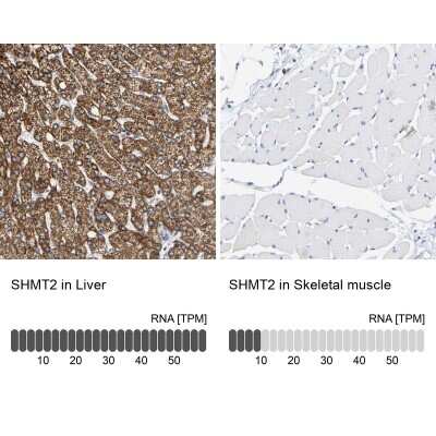 Immunohistochemistry-Paraffin: SHMT2 Antibody [NBP1-80754] - Staining in human liver and skeletal muscle tissues . Corresponding SHMT2 RNA-seq data are presented for the same tissues.