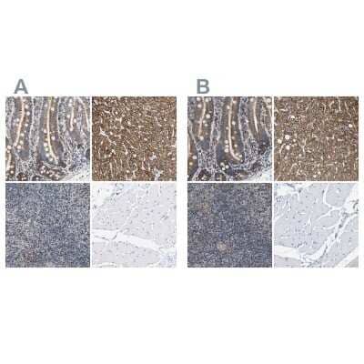 <b>Independent Antibodies Validation and Orthogonal Strategies Validation.</b>Immunohistochemistry-Paraffin: SHMT2 Antibody [NBP1-80754] - Staining of human duodenum, liver, lymph node and skeletal muscle using Anti-SHMT2 antibody NBP1-80754 (A) shows similar protein distribution across tissues to independent antibody NBP1-80755 (B).