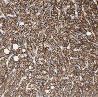 Immunohistochemistry-Paraffin: SHMT2 Antibody [NBP1-80755] - Staining of human liver shows moderate granular cytoplasmic positivity in hepatocytes.