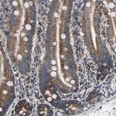 Immunohistochemistry-Paraffin: SHMT2 Antibody [NBP1-80755] - Staining of human duodenum shows moderate granular cytoplasmic positivity in glandular cells.