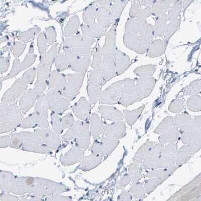 Immunohistochemistry-Paraffin: SHMT2 Antibody [NBP1-80755] - Staining of human skeletal muscle shows no positivity in myocytes as expected.